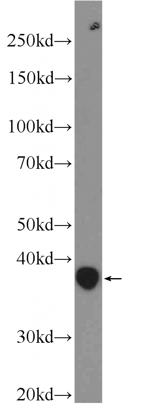 mouse testis tissue were subjected to SDS PAGE followed by western blot with Catalog No:108080(ANKRD54 Antibody) at dilution of 1:1000