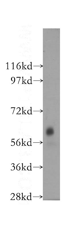 mouse skeletal muscle tissue were subjected to SDS PAGE followed by western blot with Catalog No:110034(DTNB antibody) at dilution of 1:300