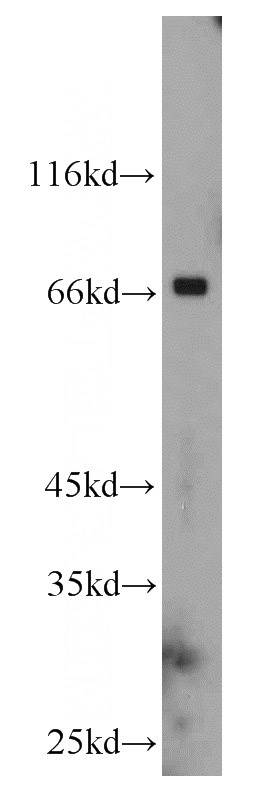 mouse heart tissue were subjected to SDS PAGE followed by western blot with Catalog No:109298(CHST3 antibody) at dilution of 1:800