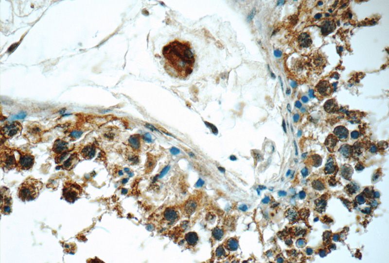 Immunohistochemistry of paraffin-embedded human testis tissue slide using Catalog No:113779(PGBD1 Antibody) at dilution of 1:50 (under 40x lens)