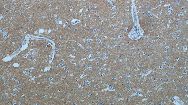 Immunohistochemical of paraffin-embedded human brain using Catalog No:113274(NRCAM antibody) at dilution of 1:50 (under 10x lens)