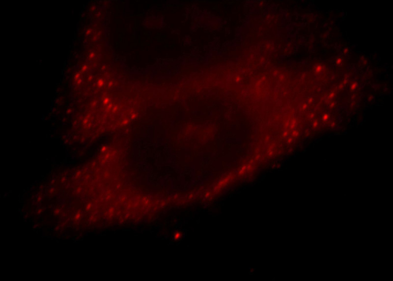 Immunofluorescent analysis of HepG2 cells, using TRIM41 antibody Catalog No:116316 at 1:25 dilution and Rhodamine-labeled goat anti-rabbit IgG (red).