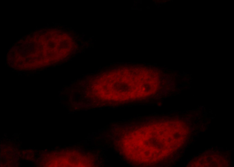 Immunofluorescent analysis of HepG2 cells, using DIDO1 antibody Catalog No:109941 at 1:25 dilution and Rhodamine-labeled goat anti-rabbit IgG (red).