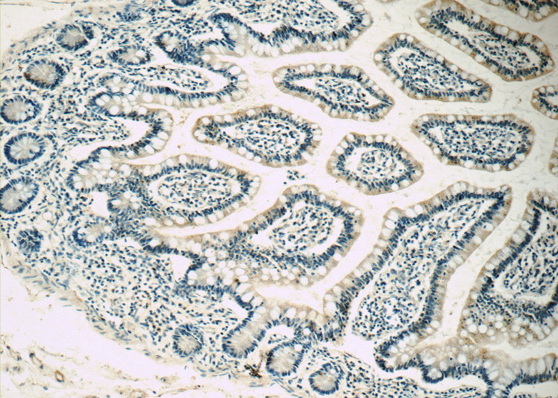 Immunohistochemistry of paraffin-embedded human small intestine tissue slide using Catalog No:112541(MC3R Antibody) at dilution of 1:50 (under 10x lens)