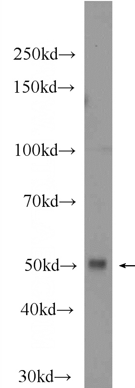 Raji cells were subjected to SDS PAGE followed by western blot with Catalog No:111840(IRF8 Antibody) at dilution of 1:1000