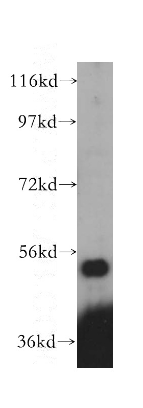 HepG2 cells were subjected to SDS PAGE followed by western blot with Catalog No:113877(PI4K2B antibody) at dilution of 1:400