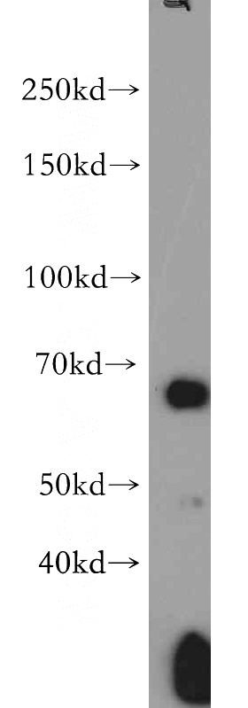 human skeletal muscle tissue were subjected to SDS PAGE followed by western blot with Catalog No:108007(PRKAA2 antibody) at dilution of 1:500