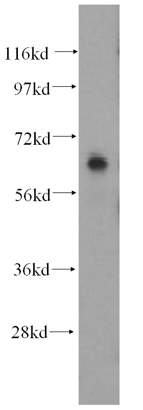 HeLa cells were subjected to SDS PAGE followed by western blot with Catalog No:110775(FZD9 antibody) at dilution of 1:500