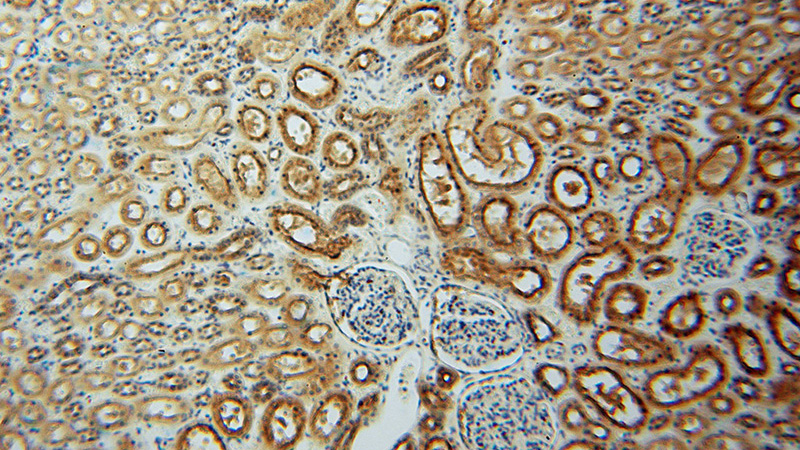 Immunohistochemical of paraffin-embedded human kidney using Catalog No:108314(ATP6V1G1 antibody) at dilution of 1:100 (under 10x lens)