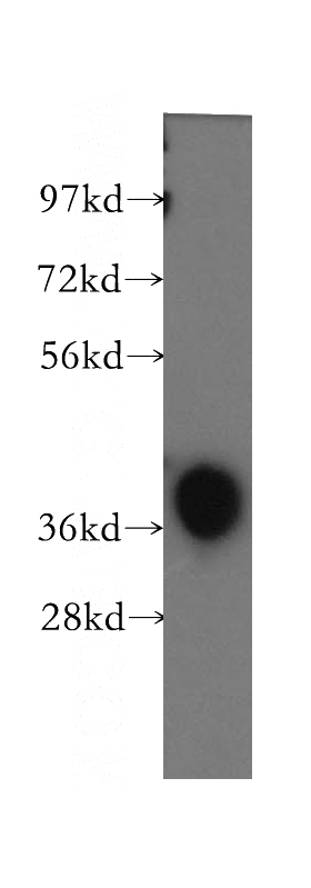 human brain tissue were subjected to SDS PAGE followed by western blot with Catalog No:115844(TALDO1 antibody) at dilution of 1:500