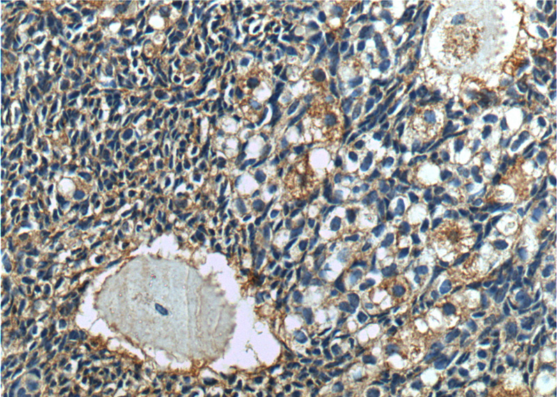 Immunohistochemistry of paraffin-embedded human ovary tissue slide using Catalog No:109715(Cystatin C Antibody) at dilution of 1:200 (under 40x lens).