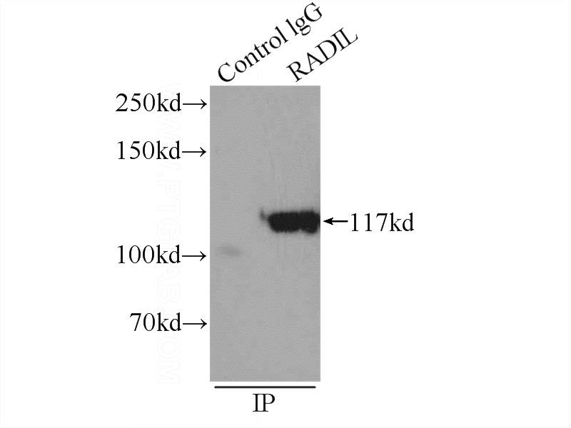 IP Result of anti-RADIL (IP:Catalog No:114520, 5ug; Detection:Catalog No:114520 1:800) with HepG2 cells lysate 1720ug.