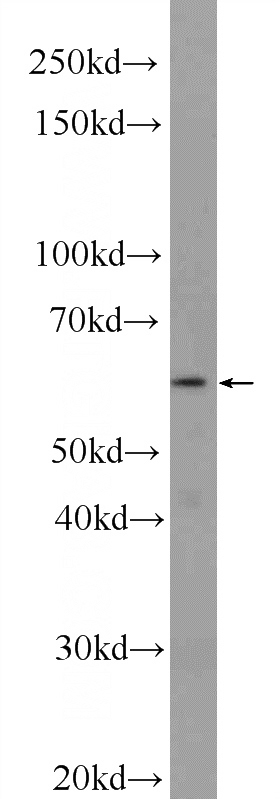 HepG2 cells were subjected to SDS PAGE followed by western blot with Catalog No:116090(TMEM102 Antibody) at dilution of 1:1000