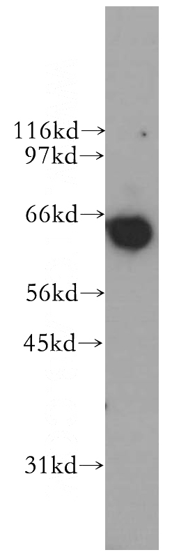 Jurkat cells were subjected to SDS PAGE followed by western blot with Catalog No:114259(PTBP1 antibody) at dilution of 1:400
