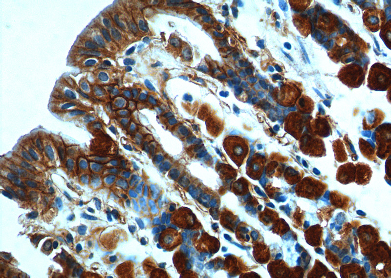 Immunohistochemistry of paraffin-embedded mouse stomach tissue slide using Catalog No:110426(Ezrin Antibody) at dilution of 1:200 (under 40x lens).