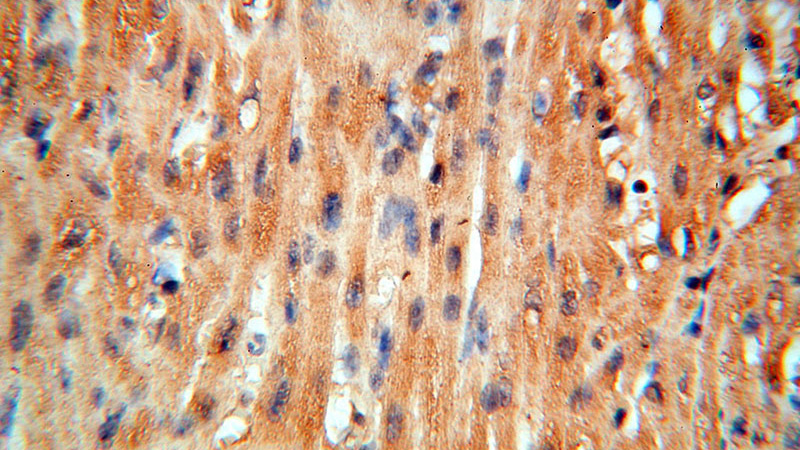 Immunohistochemical of paraffin-embedded human heart using Catalog No:109669(CCNI antibody) at dilution of 1:50 (under 40x lens)