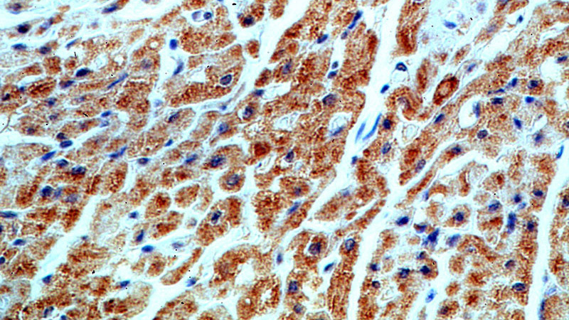 Immunohistochemical of paraffin-embedded human heart using Catalog No:115634(ST8SIA2-Specific antibody) at dilution of 1:50 (under 40x lens)