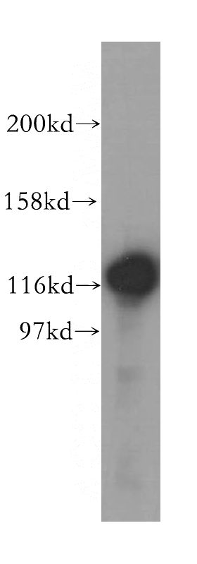 mouse thymus tissue were subjected to SDS PAGE followed by western blot with Catalog No:115288(SKIV2L2 antibody) at dilution of 1:400