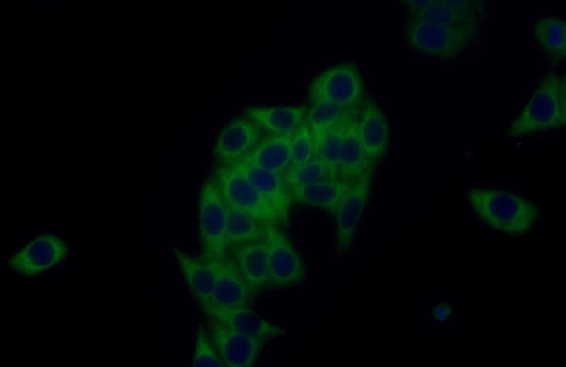 Immunofluorescent analysis of HepG2 cells using Catalog No:116340(TRAPB, SSR2 Antibody) at dilution of 1:25 and Alexa Fluor 488-congugated AffiniPure Goat Anti-Rabbit IgG(H+L)