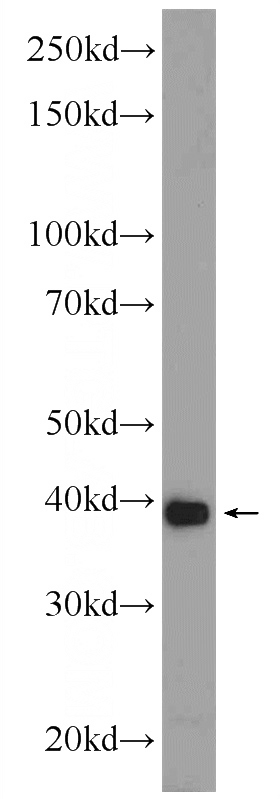 mouse kidney tissue were subjected to SDS PAGE followed by western blot with Catalog No:108713(C2orf47 Antibody) at dilution of 1:600
