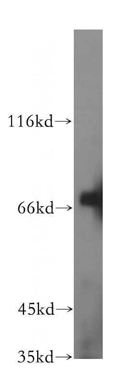 mouse brain tissue were subjected to SDS PAGE followed by western blot with Catalog No:111584(ICA1L antibody) at dilution of 1:500