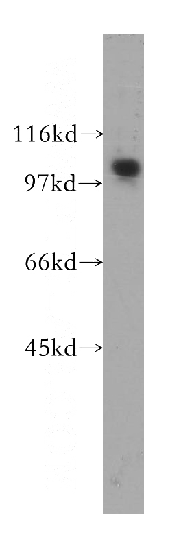 Raji cells were subjected to SDS PAGE followed by western blot with Catalog No:115474(SNX19 antibody) at dilution of 1:500