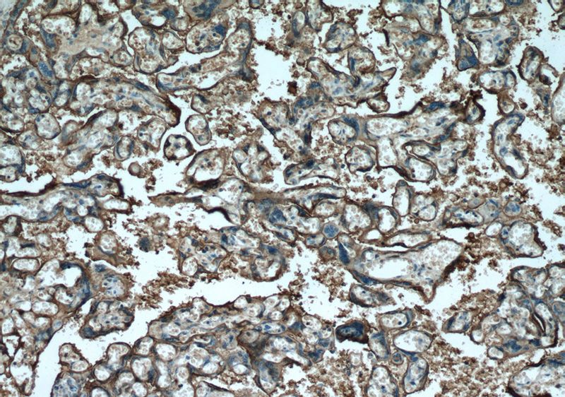 Immunohistochemistry of paraffin-embedded human placenta tissue slide using Catalog No:107476(ALPP Antibody) at dilution of 1:100 (under 10x lens)