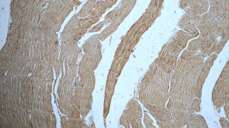 Immunohistochemistry of paraffin-embedded human skeletal muscle tissue slide using Catalog No:115779(SYNC Antibody) at dilution of 1:50 (under 10x lens)