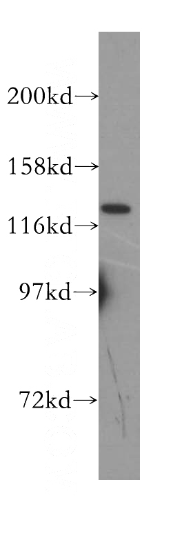 HeLa cells were subjected to SDS PAGE followed by western blot with Catalog No:112338(LRRC8D antibody) at dilution of 1:400