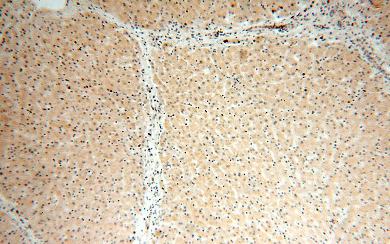 Immunohistochemical of paraffin-embedded human liver using Catalog No:107819(ABLIM1 antibody) at dilution of 1:100 (under 10x lens)