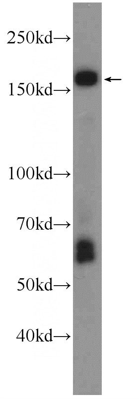 mouse brain tissue were subjected to SDS PAGE followed by western blot with Catalog No:107682(ABCA8 Antibody) at dilution of 1:300