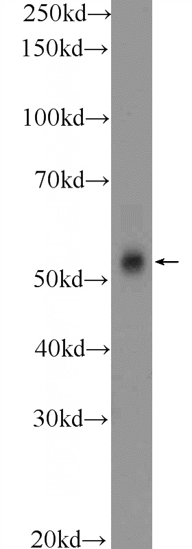mouse testis tissue were subjected to SDS PAGE followed by western blot with Catalog No:108983(CCDC62 Antibody) at dilution of 1:600