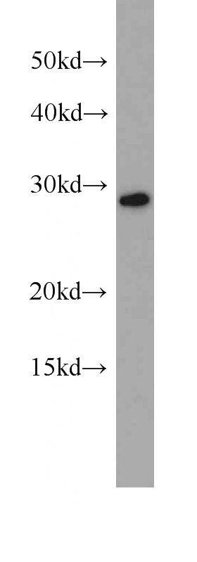 HEK-293 cells were subjected to SDS PAGE followed by western blot with Catalog No:107192(HSD17B10 antibody) at dilution of 1:1000