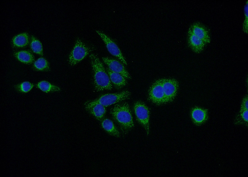 Immunofluorescent analysis of HeLa cells using Catalog No:116777(VPS26A Antibody) at dilution of 1:50 and Alexa Fluor 488-congugated AffiniPure Goat Anti-Rabbit IgG(H+L)