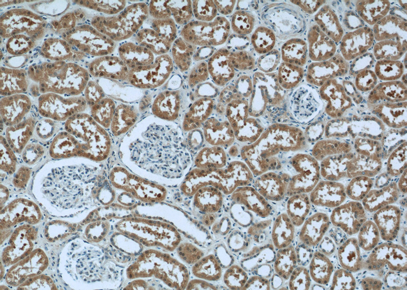 Immunohistochemistry of paraffin-embedded human kidney tissue slide using Catalog No:112407(LYN Antibody) at dilution of 1:50 (under 10x lens)