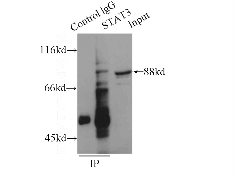 IP Result of anti-STAT3 (IP:Catalog No:115687, 4ug; Detection:Catalog No:115687 1:500) with HeLa cells lysate 1500ug.
