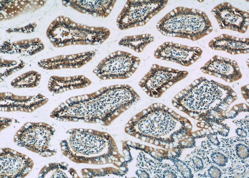 Immunohistochemistry of paraffin-embedded human small intestine tissue slide using Catalog No:111077(SLC2A2 Antibody) at dilution of 1:50 (under 10x lens)