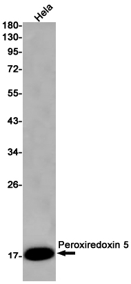 Western blot detection of Peroxiredoxin 5 in Hela cell lysates using Peroxiredoxin 5 Rabbit pAb(1:1000 diluted).Predicted band size:22kDa.Observed band size:17kDa.