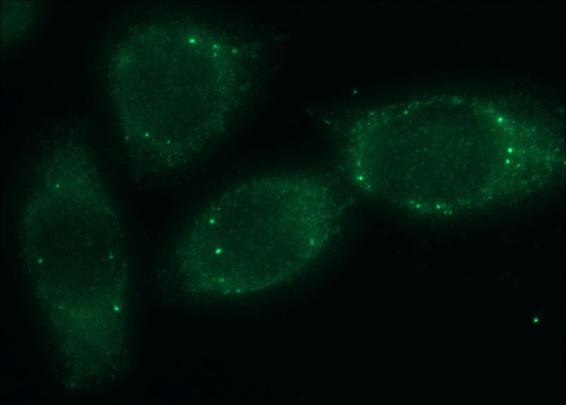 Immunofluorescent analysis of MCF-7 cells using Catalog No:116057(THRSP Antibody) at dilution of 1:25 and Alexa Fluor 488-congugated AffiniPure Goat Anti-Rabbit IgG(H+L)