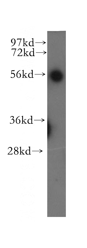 human heart tissue were subjected to SDS PAGE followed by western blot with Catalog No:116473(UBAP1 antibody) at dilution of 1:500