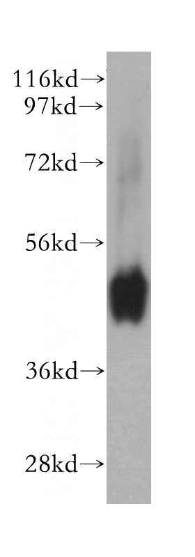 human colon tissue were subjected to SDS PAGE followed by western blot with Catalog No:113257(NMUR1 antibody) at dilution of 1:300