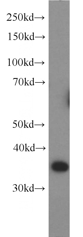 HeLa cells were subjected to SDS PAGE followed by western blot with Catalog No:111476(HMG20B antibody) at dilution of 1:800