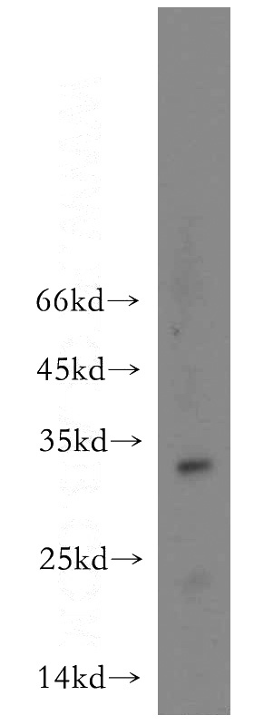 human skeletal muscle tissue were subjected to SDS PAGE followed by western blot with Catalog No:113333(OGFOD2 antibody) at dilution of 1:500