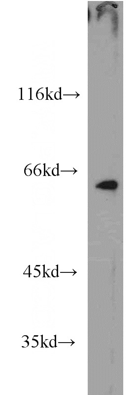 HEK-293 cells were subjected to SDS PAGE followed by western blot with Catalog No:112239(LIN9 antibody) at dilution of 1:1000