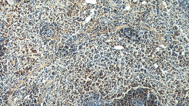 Immunohistochemistry of paraffin-embedded mouse spleen tissue slide using Catalog No:114322(PTPN5 Antibody) at dilution of 1:200 (under 10x lens).