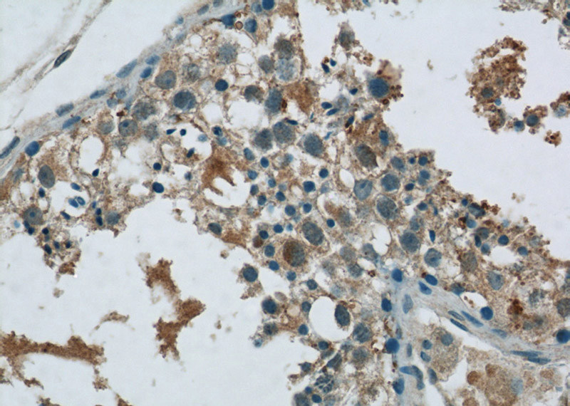 Immunohistochemistry of paraffin-embedded human testis tissue slide using Catalog No:112524(MEX3C Antibody) at dilution of 1:50 (under 40x lens)