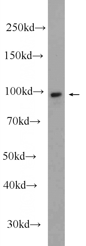 mouse uterus tissue were subjected to SDS PAGE followed by western blot with Catalog No:107869(CTNNA1 Antibody) at dilution of 1:2000