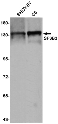 Western blot detection of SF3B3 in SHSY-5Y,C6 cell lysates using SF3B3 Rabbit pAb(1:1000 diluted).Predicted band size:136KDa.Observed band size:136KDa.
