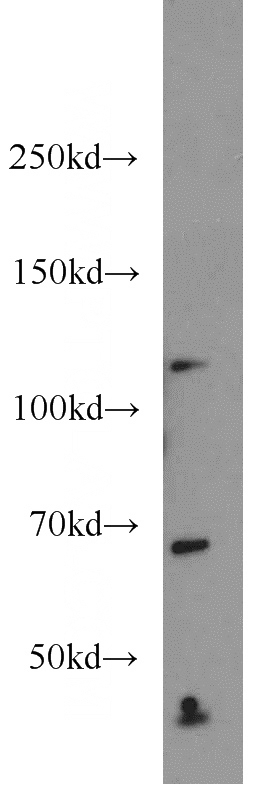 HeLa cells were subjected to SDS PAGE followed by western blot with Catalog No:115080(SEC24C antibody) at dilution of 1:500