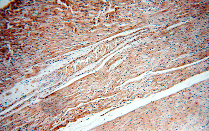 Immunohistochemical of paraffin-embedded human heart using Catalog No:111964(KCNH7 antibody) at dilution of 1:50 (under 10x lens)